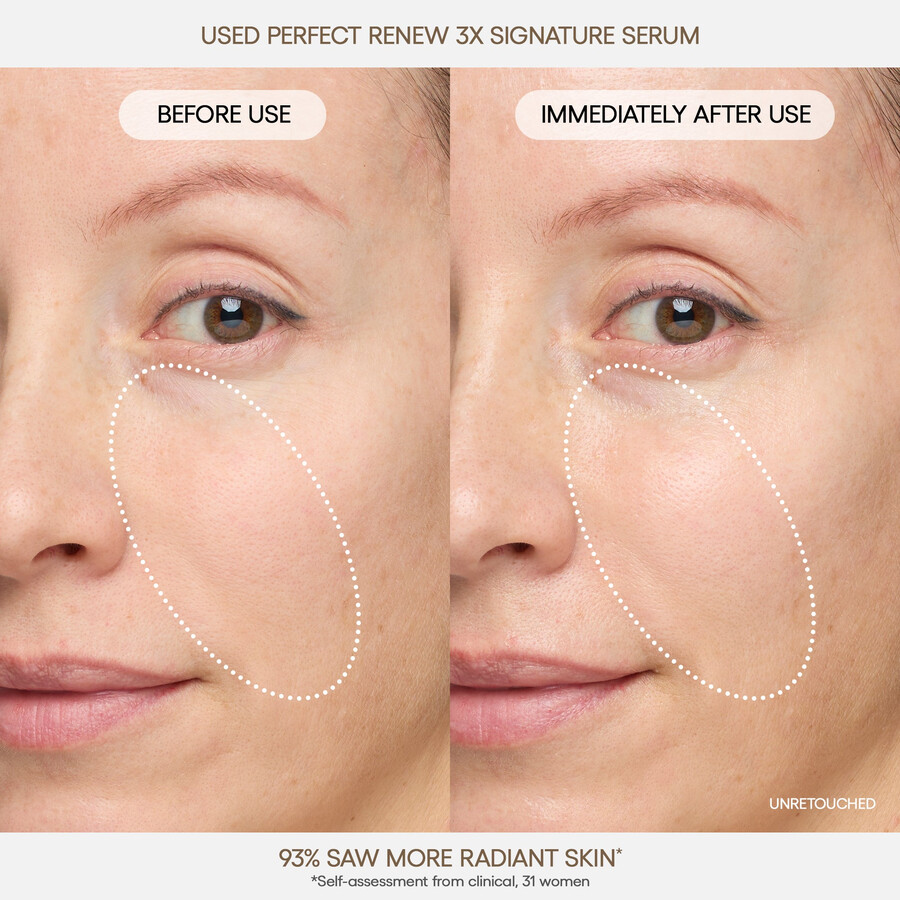 perfect renew 3x signature serum