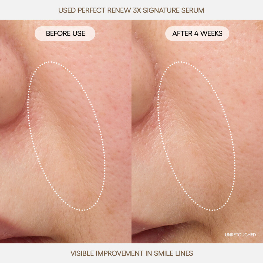 perfect renew 3x signature serum